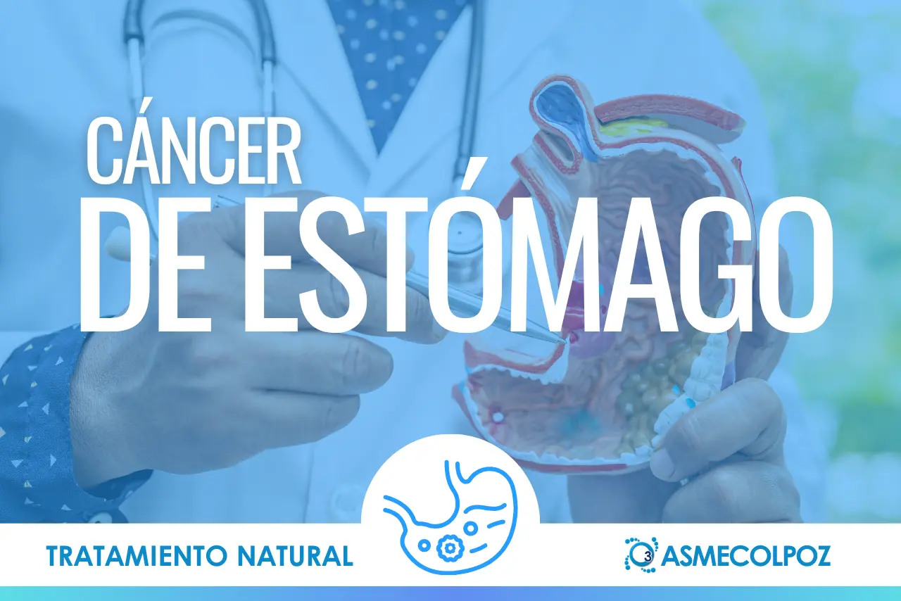 Cáncer de Estomago