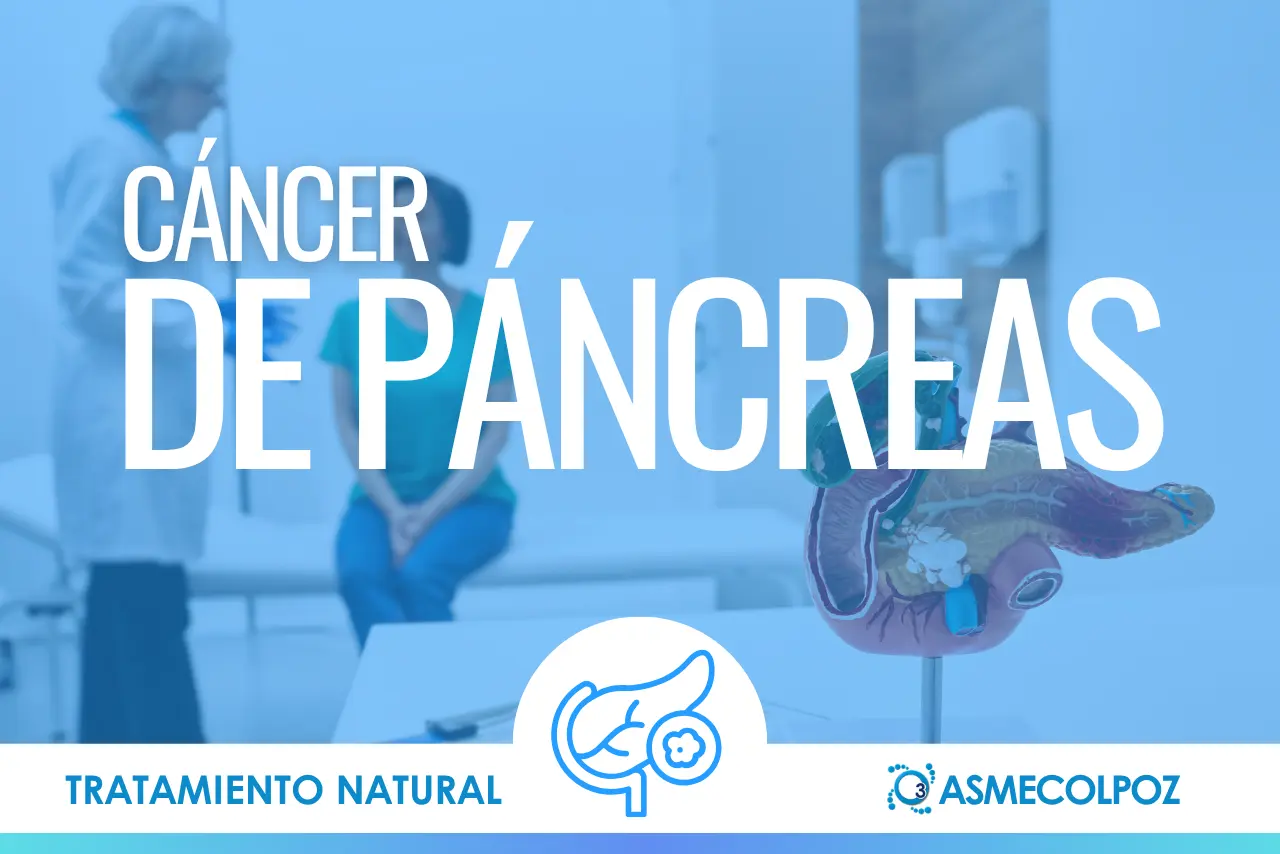 Cáncer de Páncreas